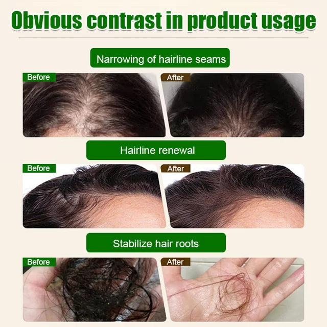 [Hair volume increases rapidly] Promote hair growth and strengthen hair care essential oil✨